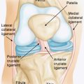 The Ease And Comfort Of Knee Arthroscopy