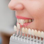 How To Care For Porcelain Veneers