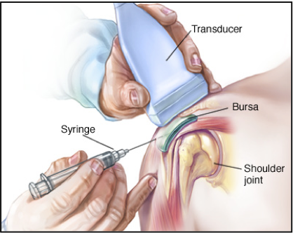 Common Complaints Addressed By Your Shoulder Surgeon