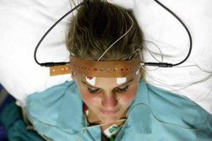 Electroconvulsive Therapy and Its Effect On The Modern World