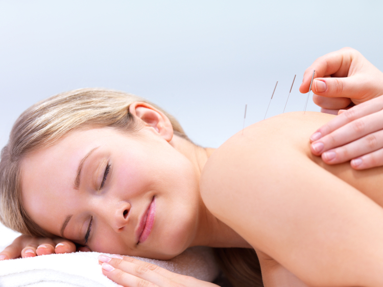 What We Should Know About Acupuncture?