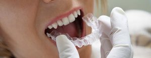 Dental braces Solihull
