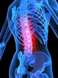 Exercises That May Help You Manage Pain In Lumbar Spinal Stenosis