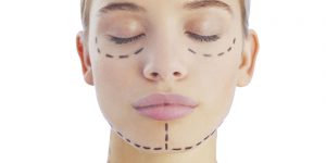 Recovery Stages After a Facelift Surgery You Should Be Aware of by iccm.com.au