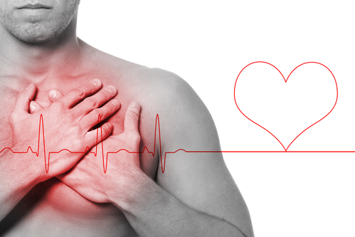 How To Live Life After A Heart Attack