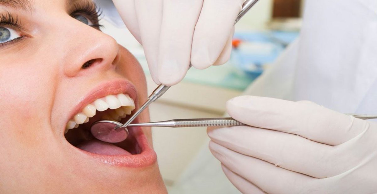 5 Signs You May Need Dental Implants