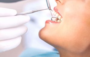 The Necessity Of Professional Dental Cleaning Services