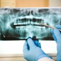 Do You Need To See A Periodontist? Here Are Some Signs To Watch Out For