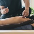 Finding The Best Acupuncturist For You