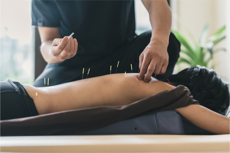 Finding The Best Acupuncturist For You