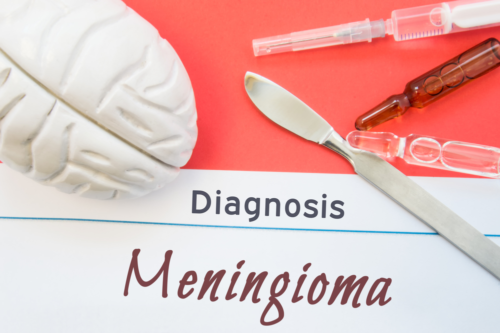 The Procedure Of Meningioma