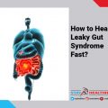 How to Heal Leaky Gut Syndrome Fast?