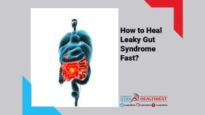 How to Heal Leaky Gut Syndrome Fast?