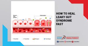 How to Heal Leaky Gut Syndrome Fast?