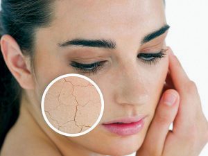 Best Skin Care Routine for Dry Skin